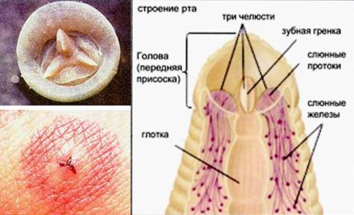 голова пиявки.png