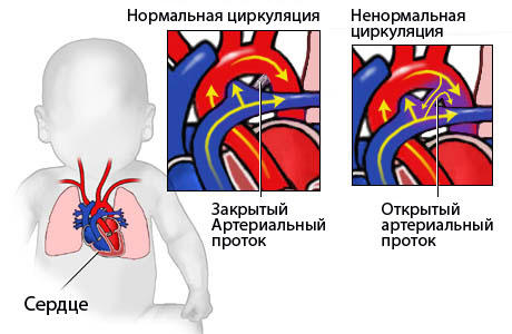 Циркуляция-крови-нарушена.jpg