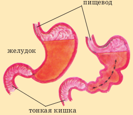 перистальтика желудка.png