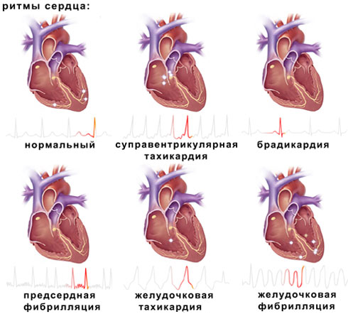 ritmi-serdca.png