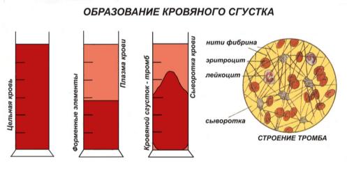 obrazovaniekrovyanogosgustka.jpg