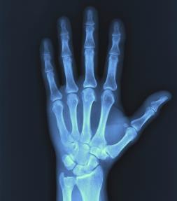 xray3.jpg