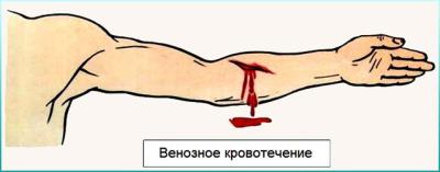 1388157567_vena_01.jpg