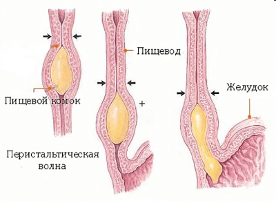patologicheskaya-anatomiya-pishhevoda.png