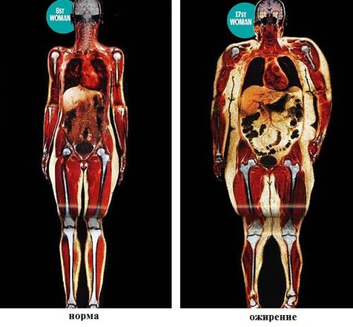 fat-vs-thin-inside.jpg