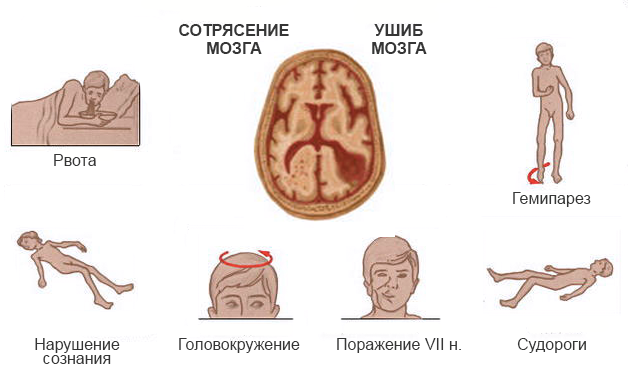 При переломе какой кости необходимо обездвижить 3 сустава книга секреты здоровья суставов и позвоночника марина авшарова